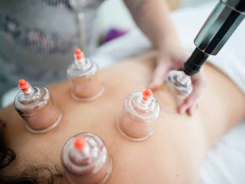 Analyse Des Effets De La Therapie Par Ventouses Sur La Peau Et LInfluence Potentielle Sur La Sante Humaine 1024x663