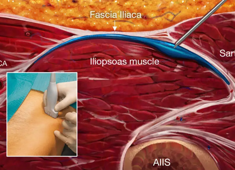 Fascia 1024x576