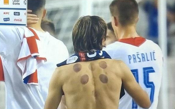 Ventouse Dos Sportif