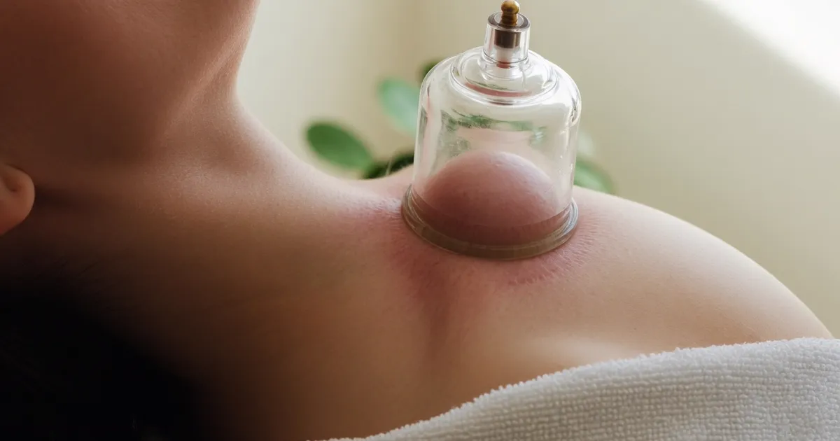 Ventouse appliquée sur la nuque pour relâcher les tensions cervicales et soulager un torticolis