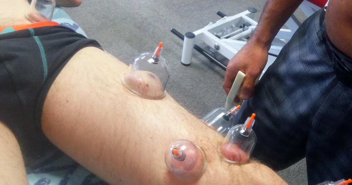 Ventouse appliquée sur le genou pour soulager l'arthrose et favoriser la récupération ligamentaire