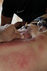 massage ventouse
