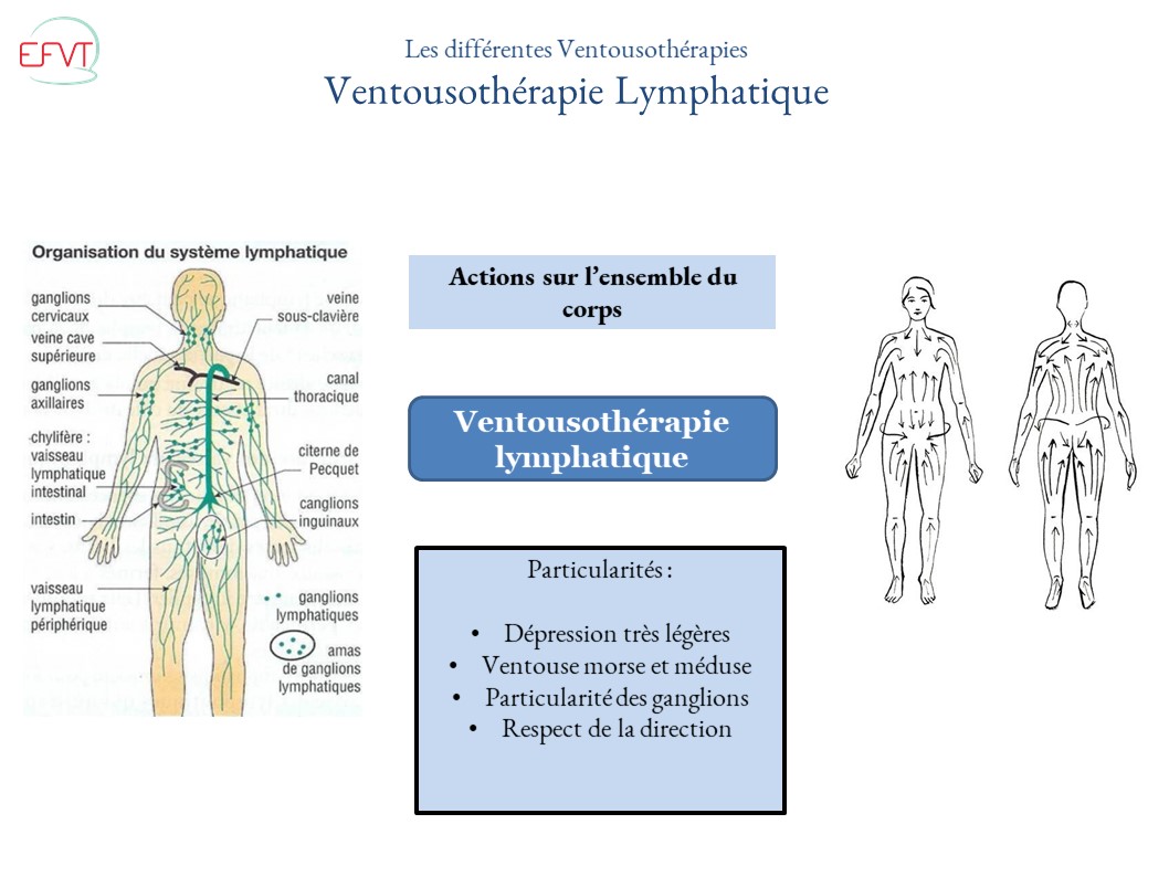 FORMATION THERAPIE DES VENTOUSES